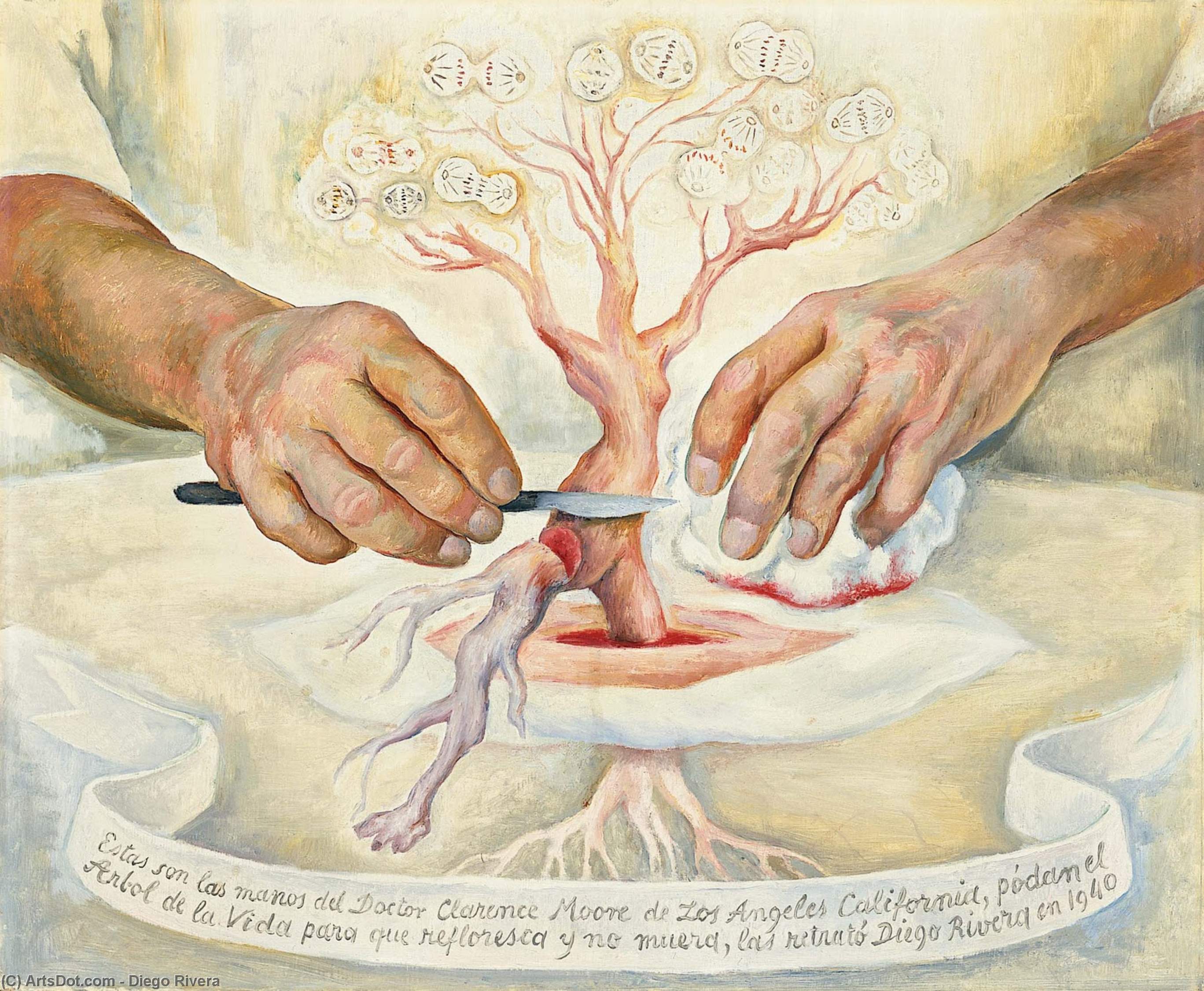 Die Hände Von Dr. Moore — Diego Rivera